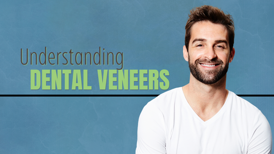 Read more about the article Understanding Dental Veneers