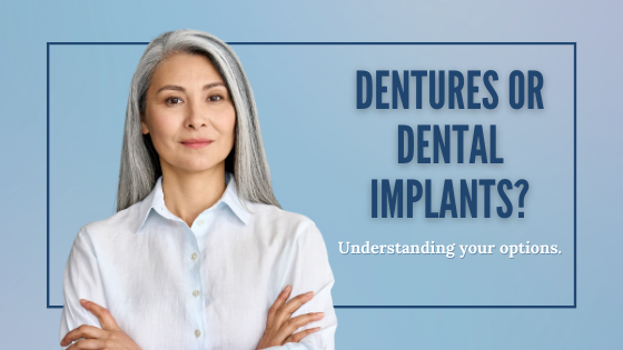 Read more about the article Dentures or Dental Implants: Understanding your Options